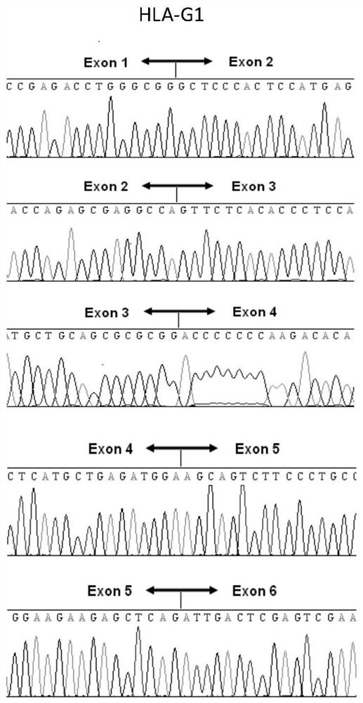 Cell strain for expressing HLA-G7 isomer standard protein and application thereof