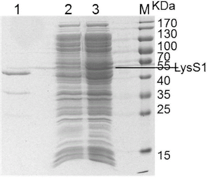 Genetic engineering-modified staphylococcus aureus staphylophage lyase as well as preparation method and application thereof