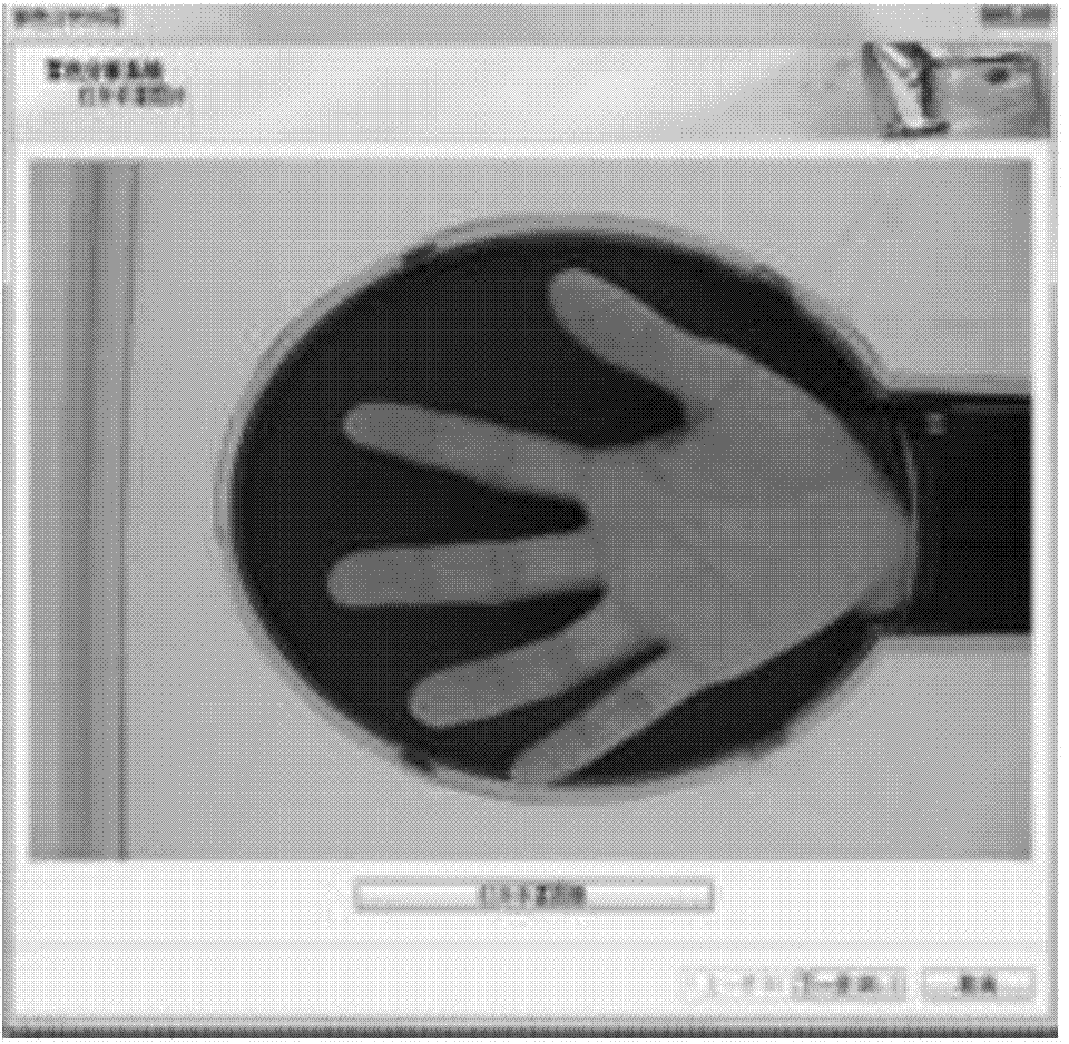 Palm color analysis method for health status identification