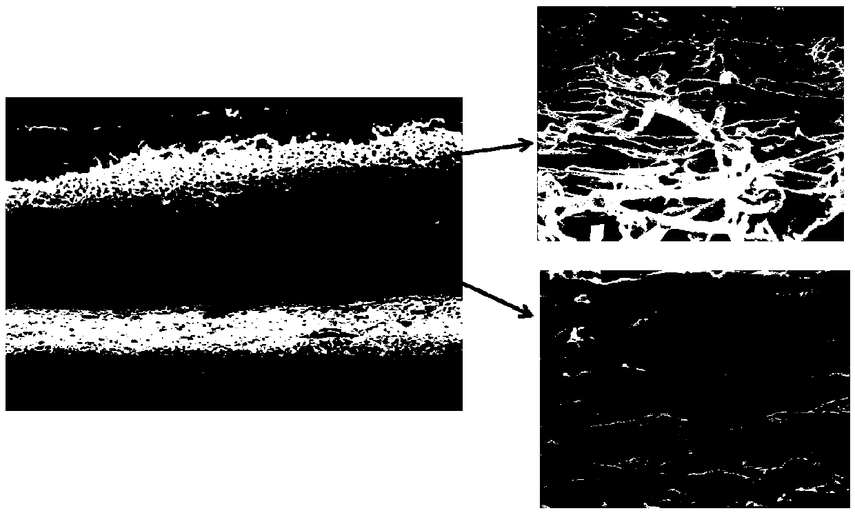 Preparation method for all-solid-state polymer electrolyte membrane with three-layer structure