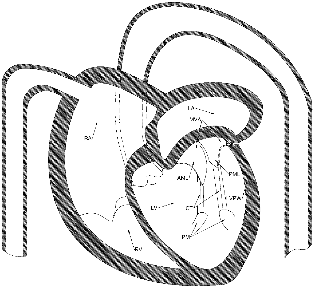 Valve contraction ring system