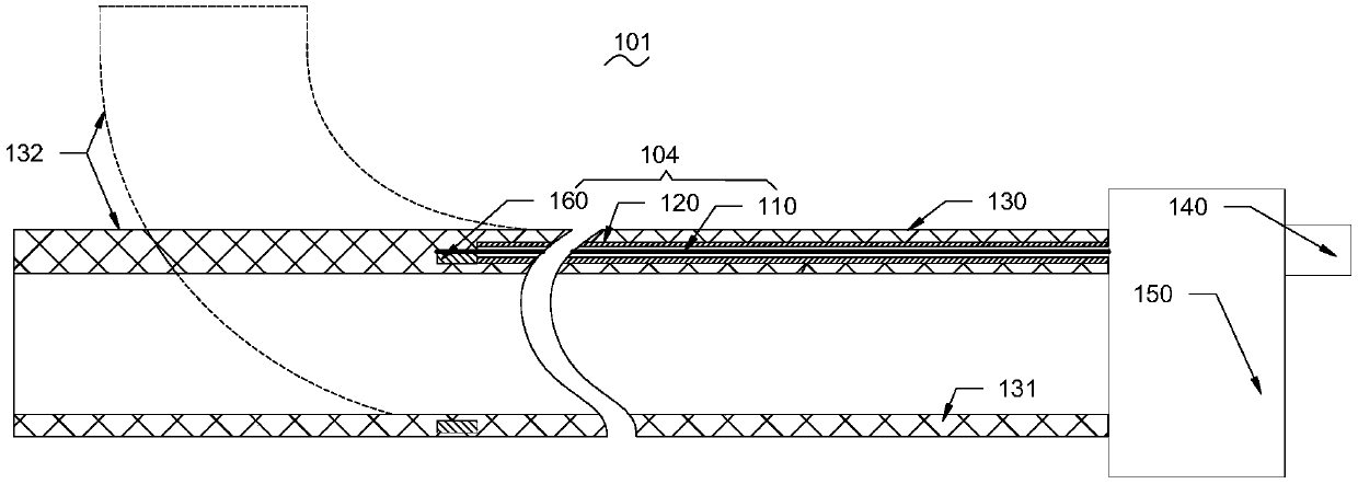 Valve contraction ring system