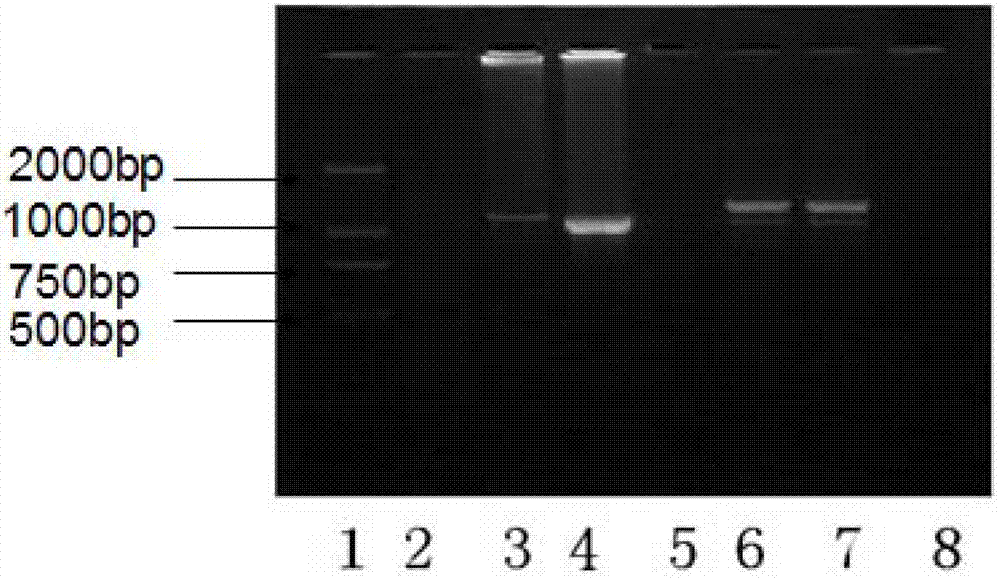 Mycoplasma pneumonia P1-RFLP gene typing and detecting primer and method