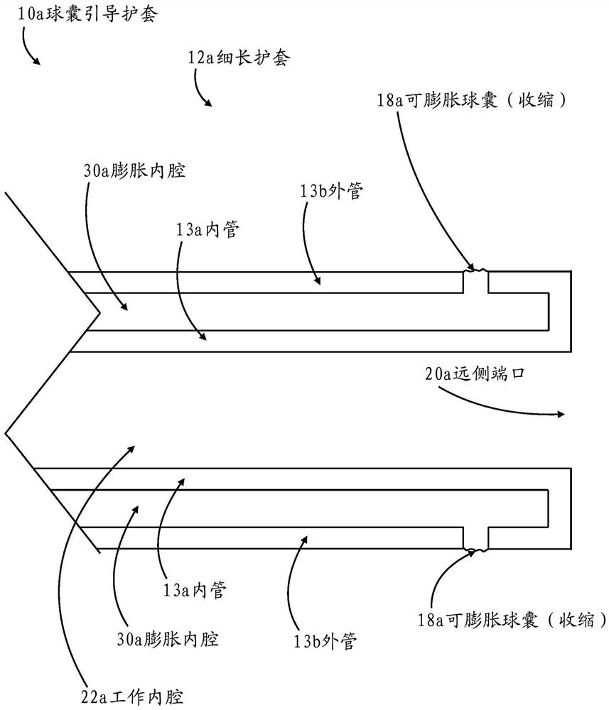 Internal carotid artery thrombectomy devices and methods