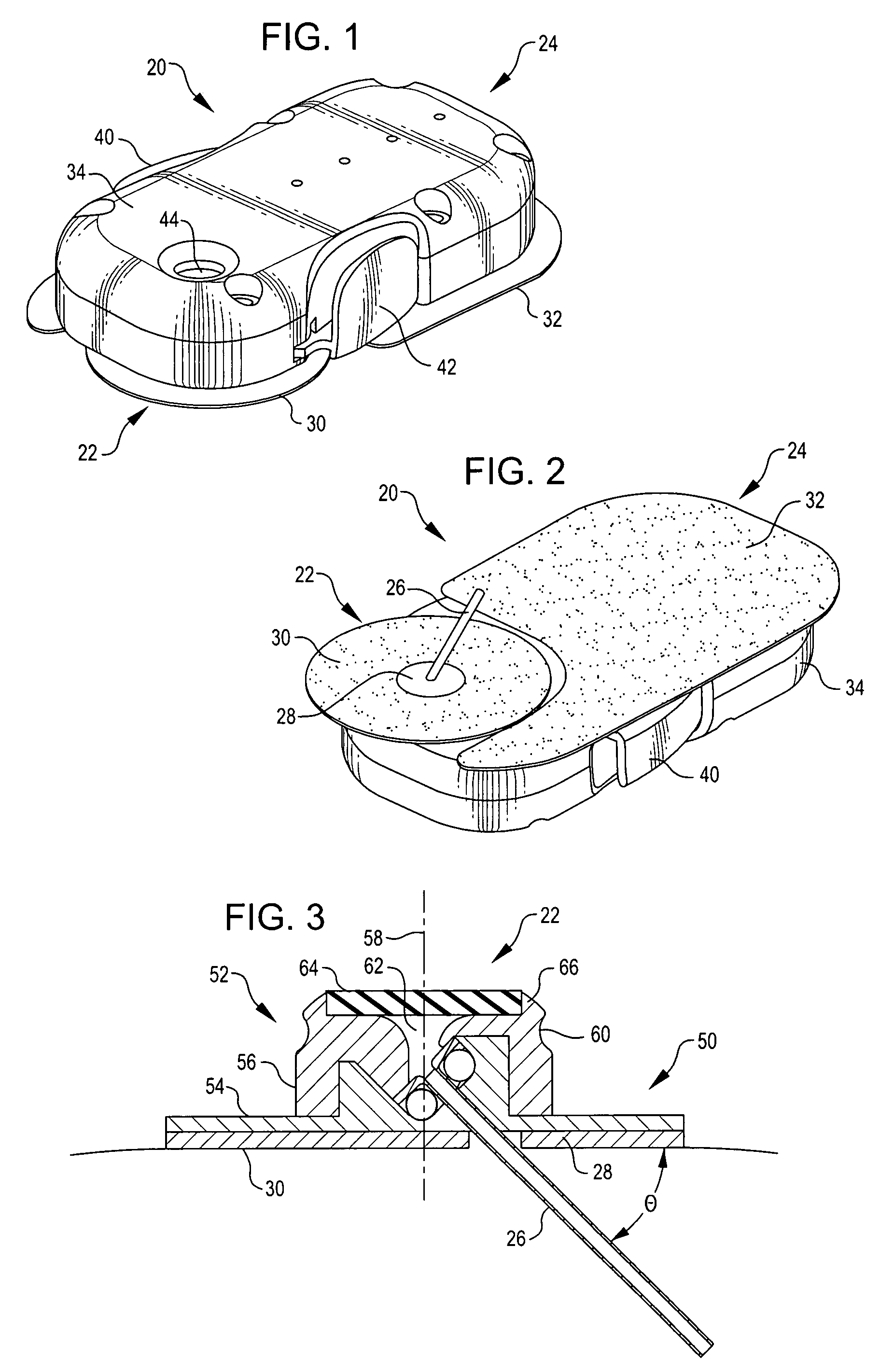 Infusion assembly