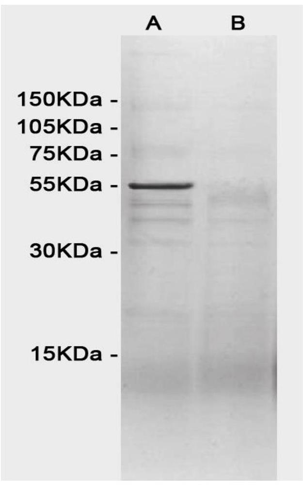 Milk, wheat, peanut and soybean allergen fused protein and construction method and application thereof