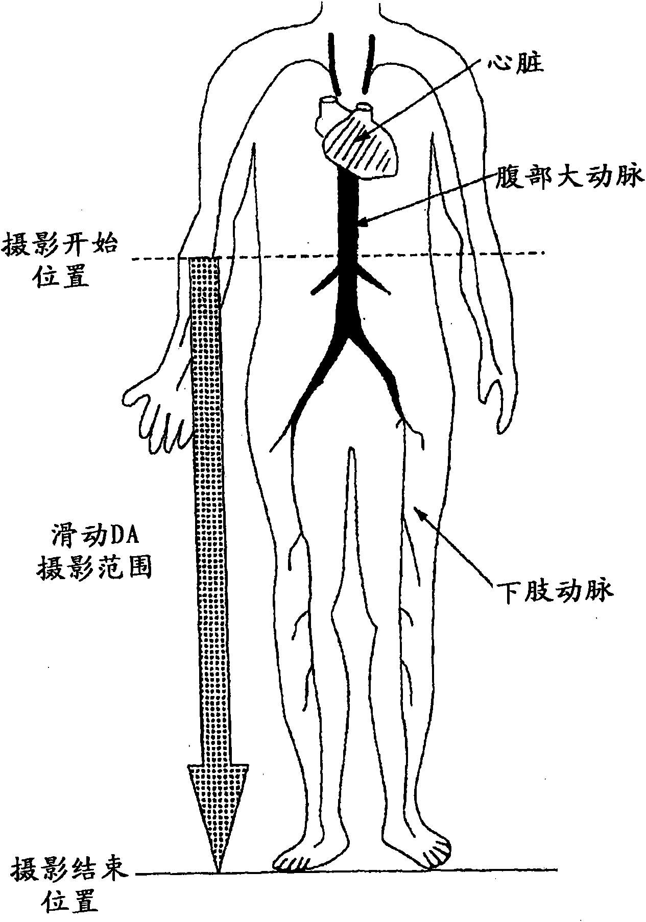 Cardiovascular x-ray diagnostic system