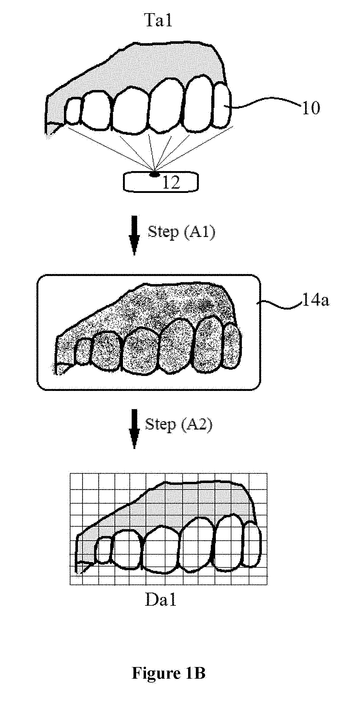 Orthodontic process with dynamic planning and incremental implementation