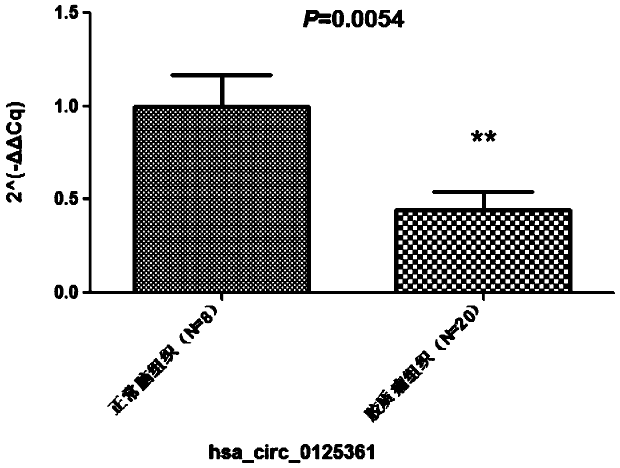 Glioma prognostic marker hsa_circ_0125361 and its application