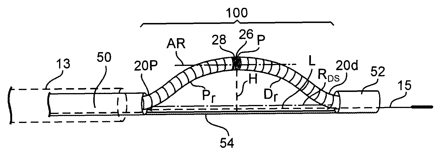 Directional rotational atherectomy device with offset spinning abrasive element