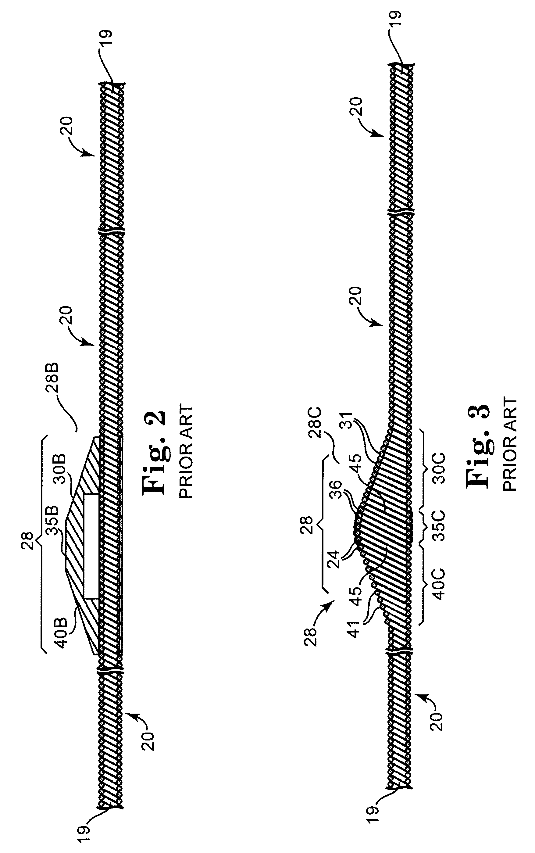 Directional rotational atherectomy device with offset spinning abrasive element