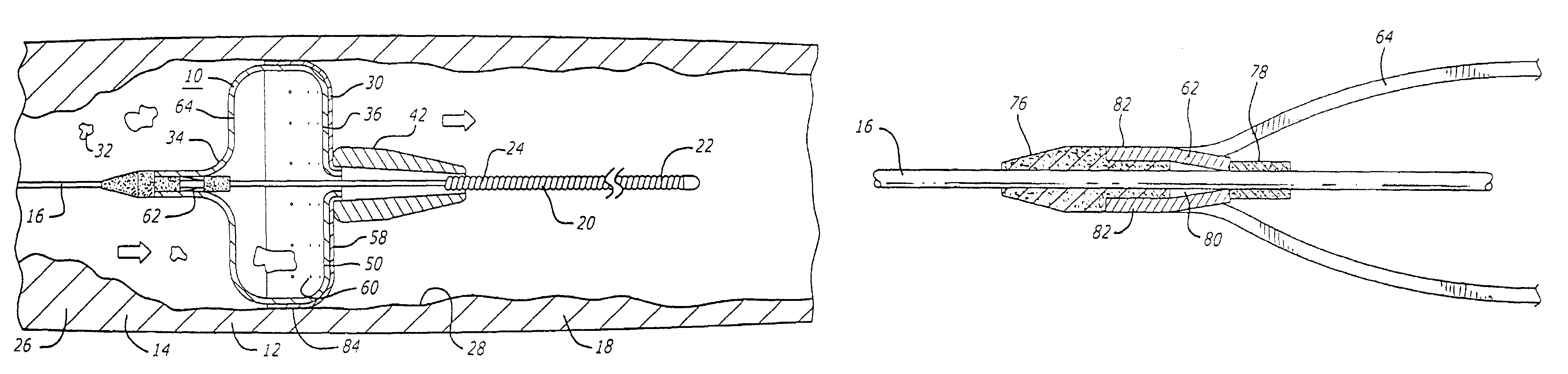 Filter device for embolic protection systems