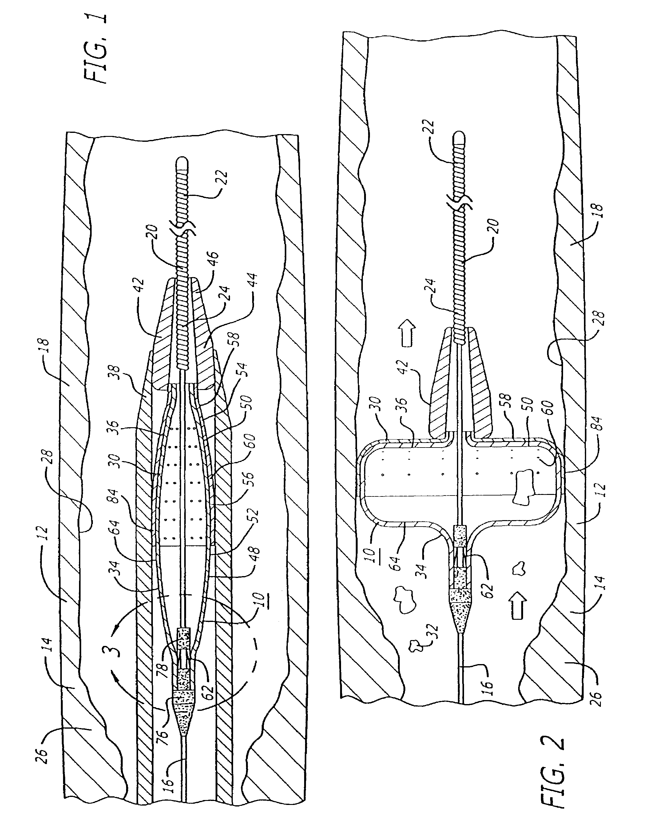 Filter device for embolic protection systems