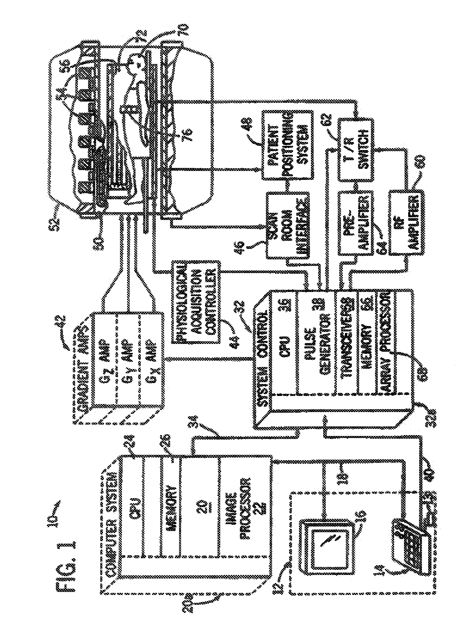 Quadrature and linear RF coil array for MRI of human spine and torso