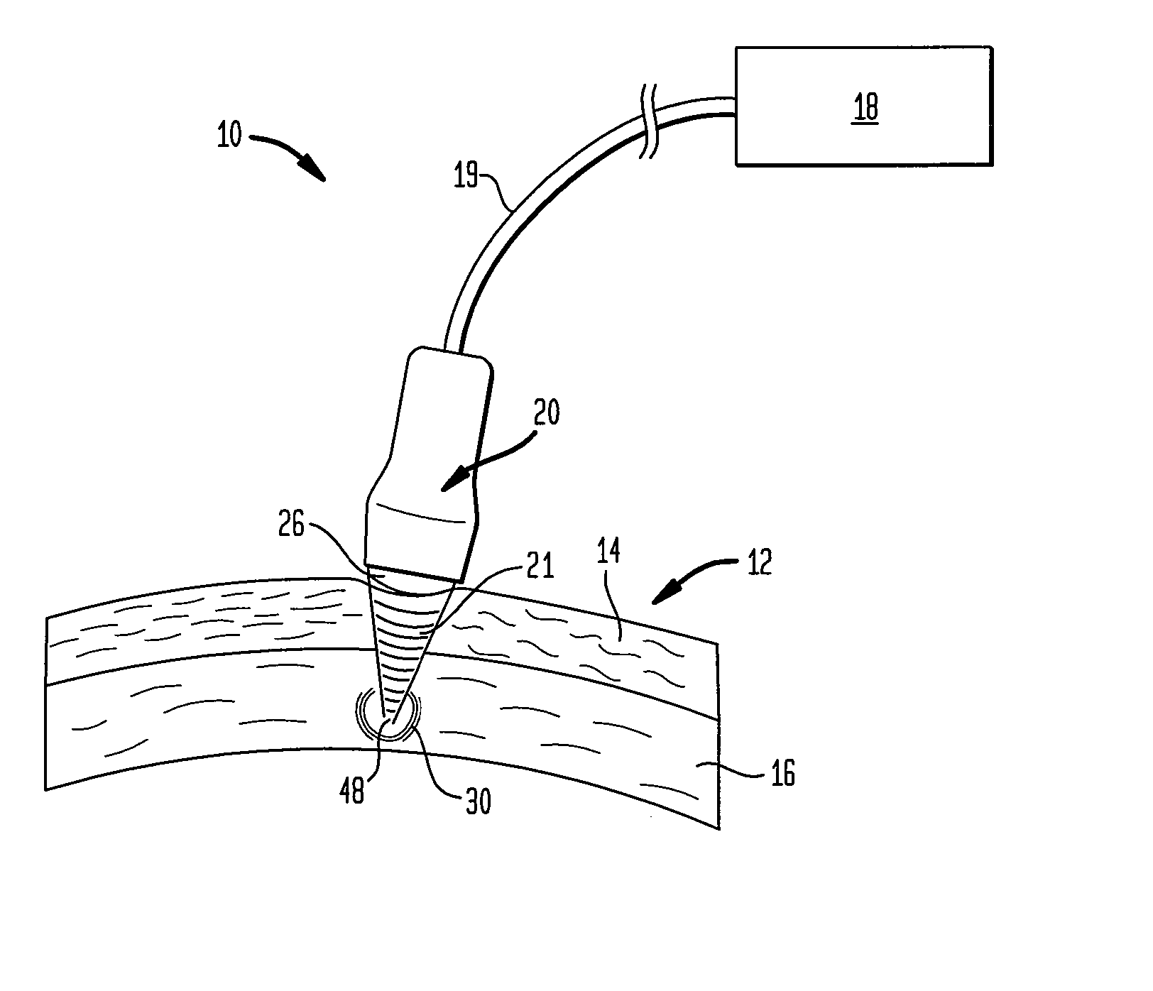 Multi-focal treatment of skin with acoustic energy