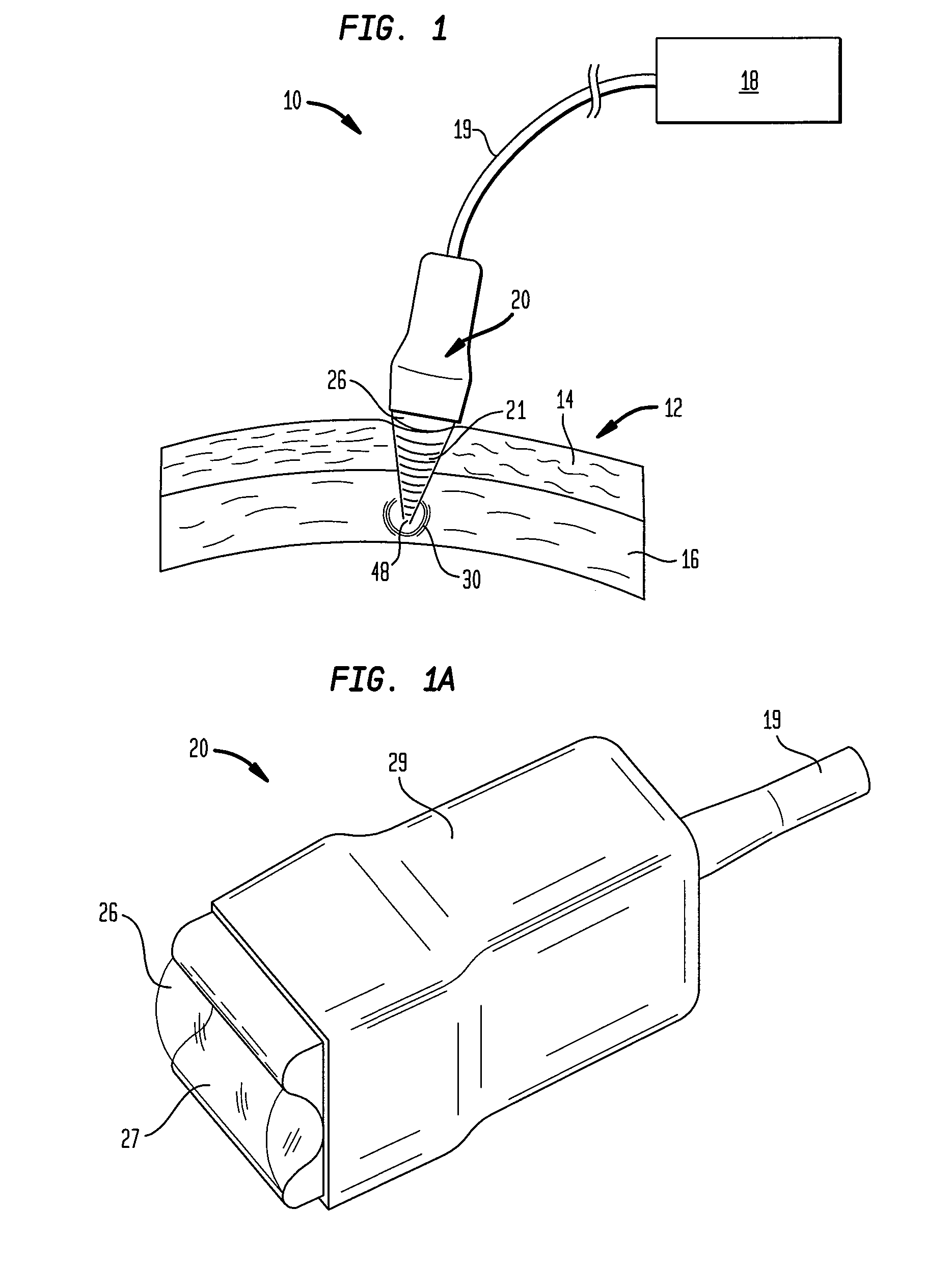 Multi-focal treatment of skin with acoustic energy