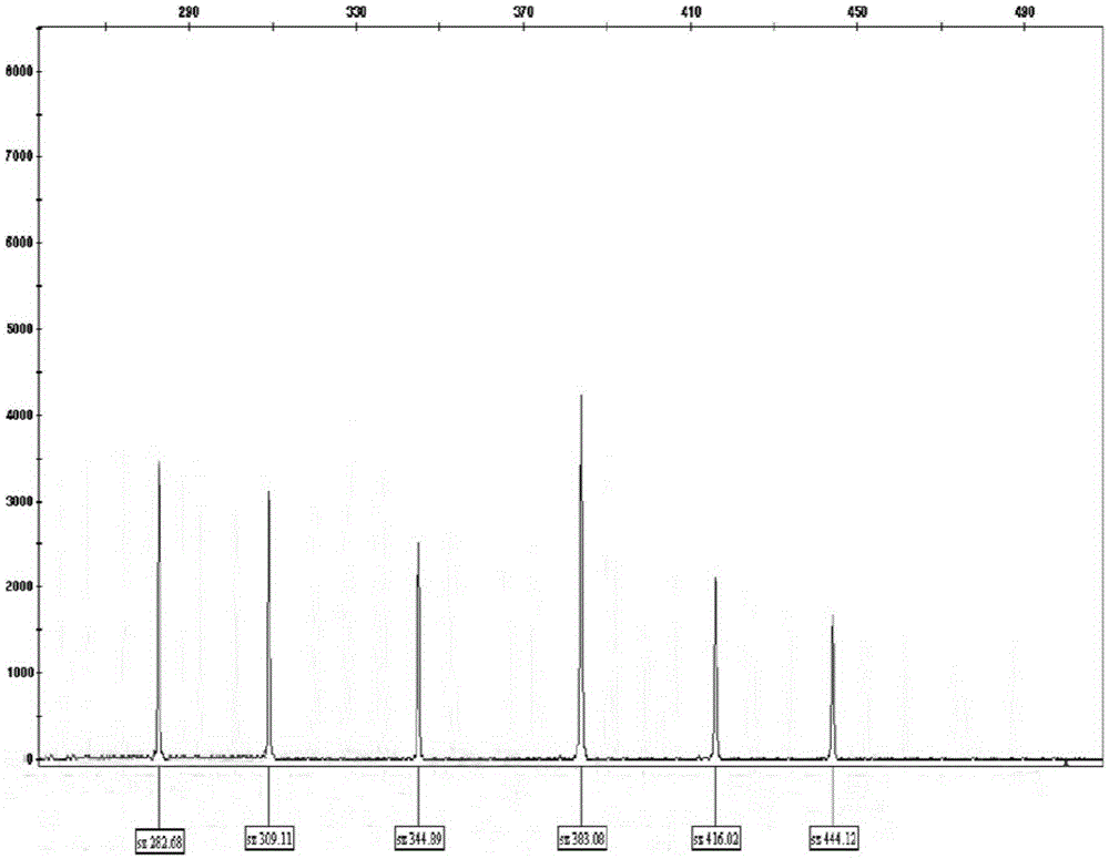 Kit for prognostic stratification of AML (Acute Myelocytic Leukemia)