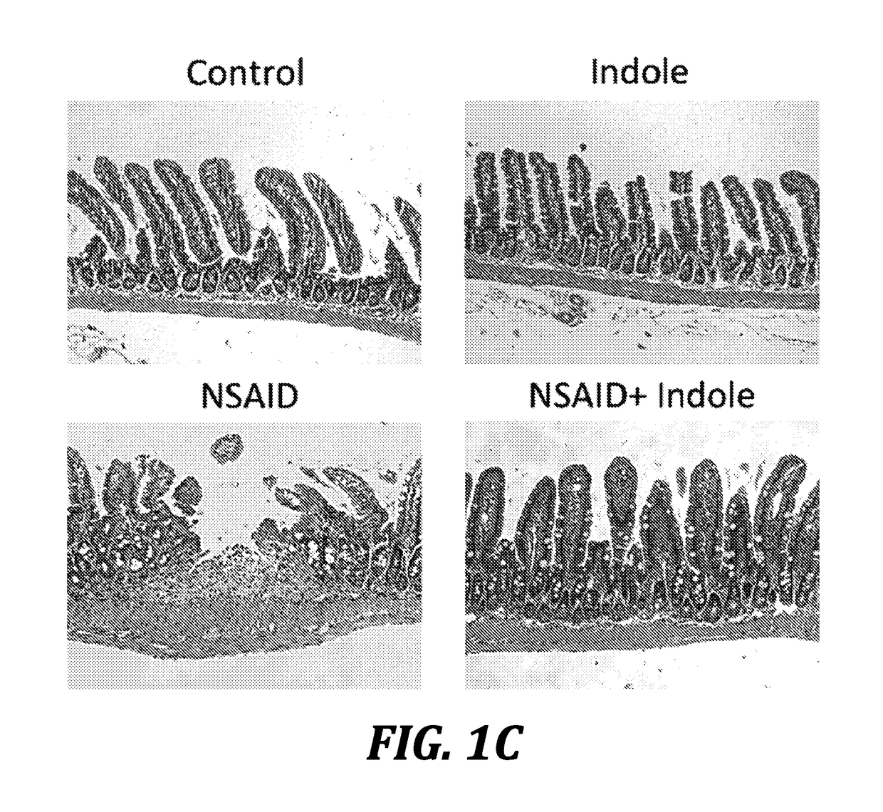 Prevention of nsaid enteropathy with microbiota-derived tryptophan-metabolite