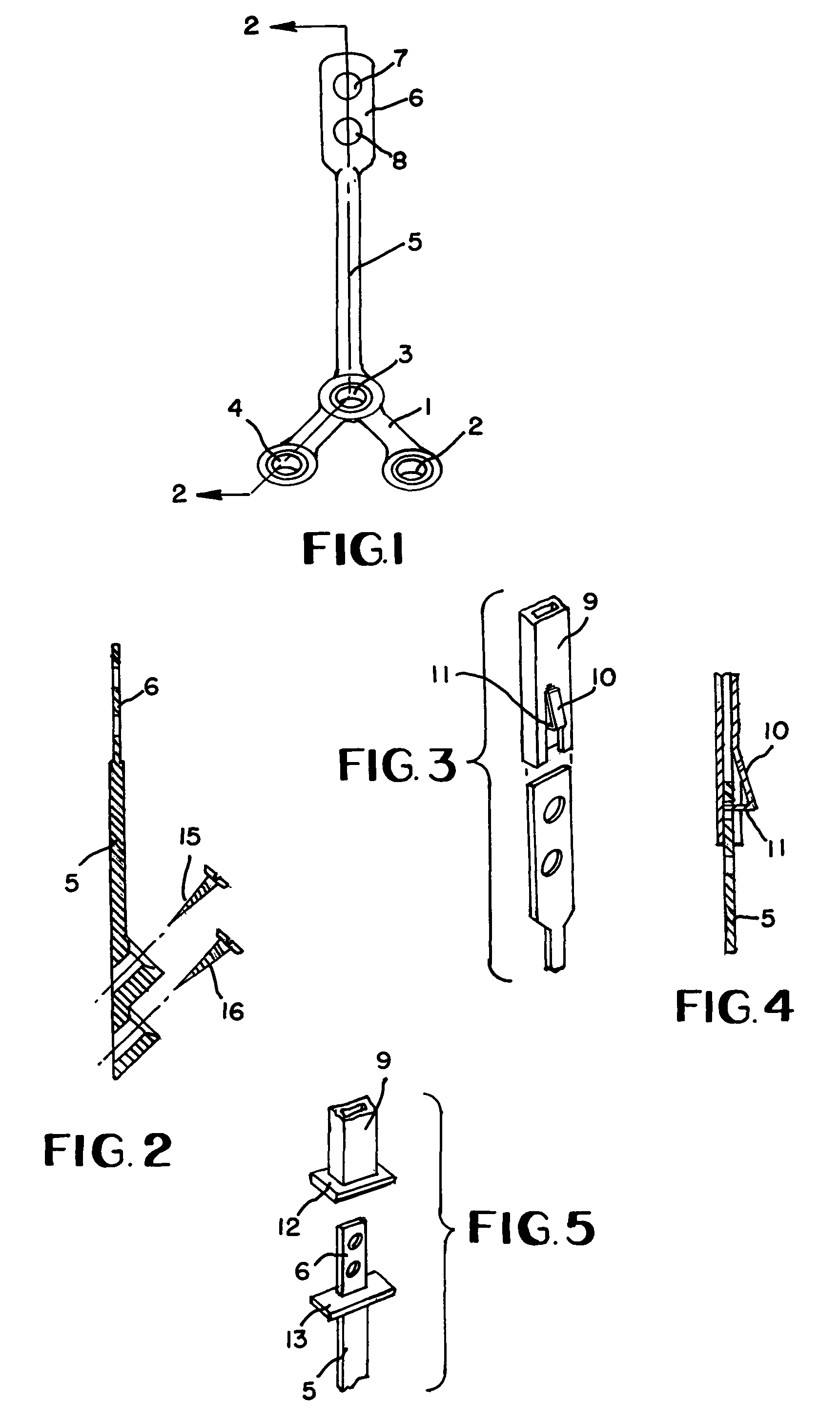 Orthodontic anchor