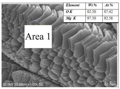 A method for comprehensive recovery of valuable metals in high magnesium silicon laterite nickel ore