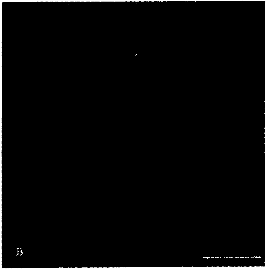 Monoclonal antibody of immunoglobulin of anti lymphocyst vitos of Pacific fluke, and preparation method