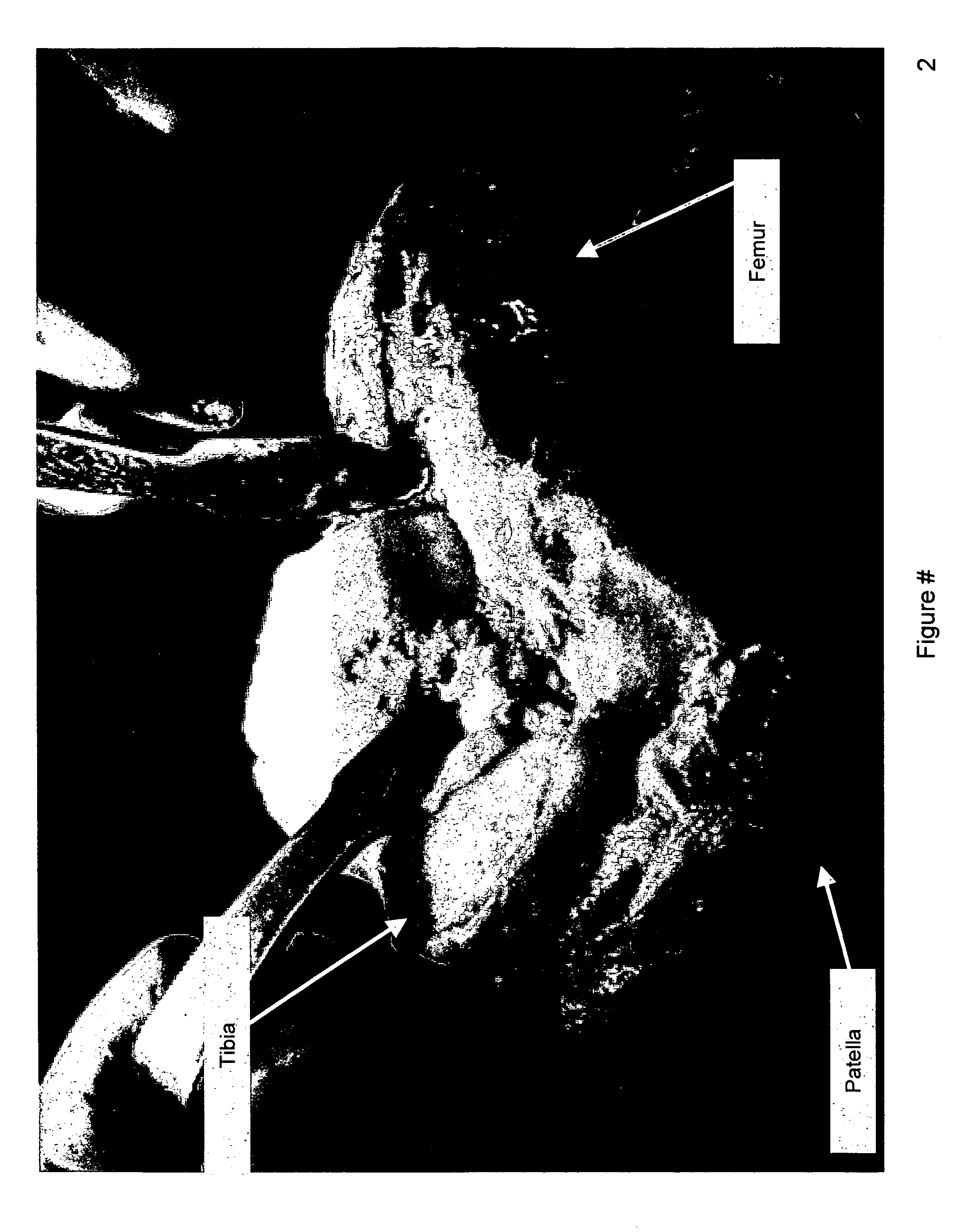 Methods and apparatus for pivotable guide surfaces for arthroplasty