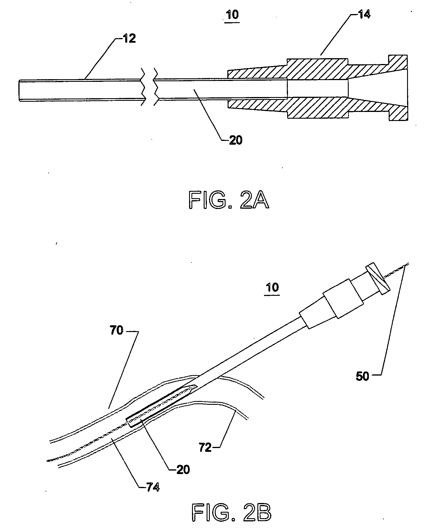 Method and apparatus for percutaneous wound sealing