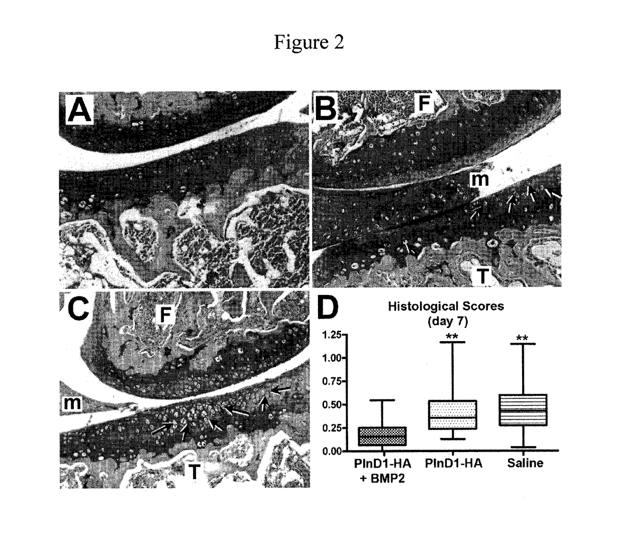 Injectable delivery system for heparan-binding growth factors