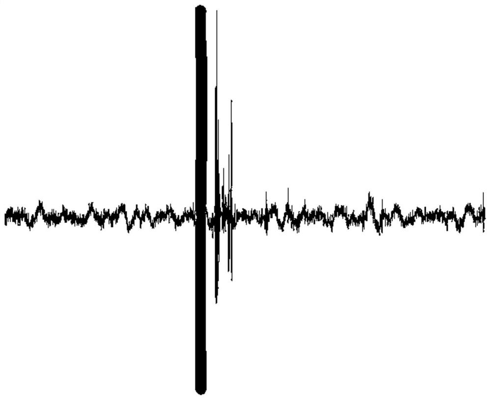 A microseismic effective signal detection method combining u-net network and densenet network