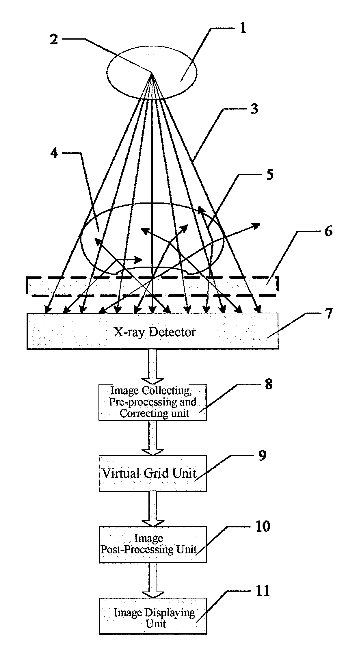 Virtual, grid imaging method and system for eliminating scattered radiation effect