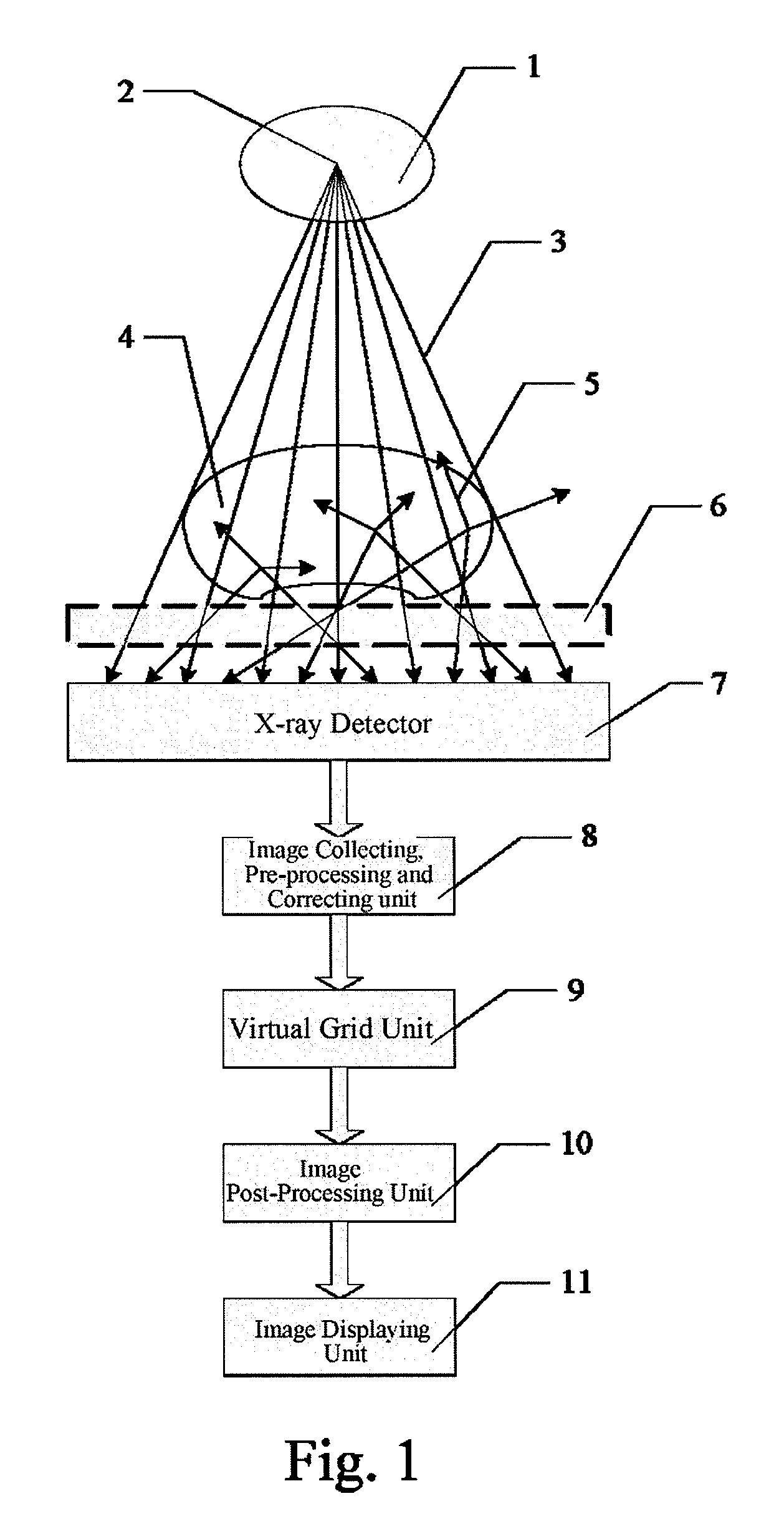 Virtual, grid imaging method and system for eliminating scattered radiation effect