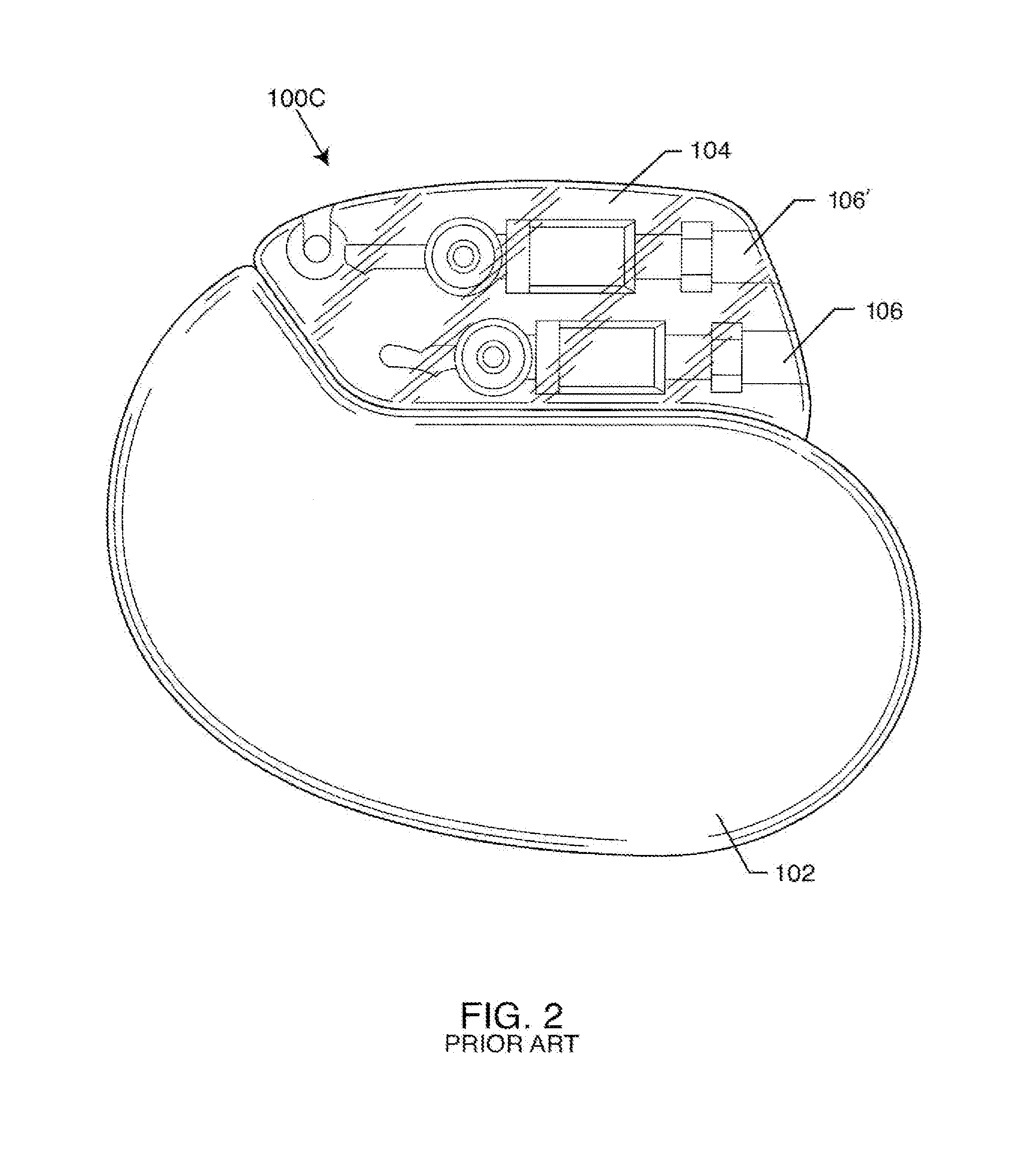 EMI Filtered Co-Connected Hermetic Feedthrough, Feedthrough Capacitor and Leadwire Assembly for an Active Implantable Medical Device