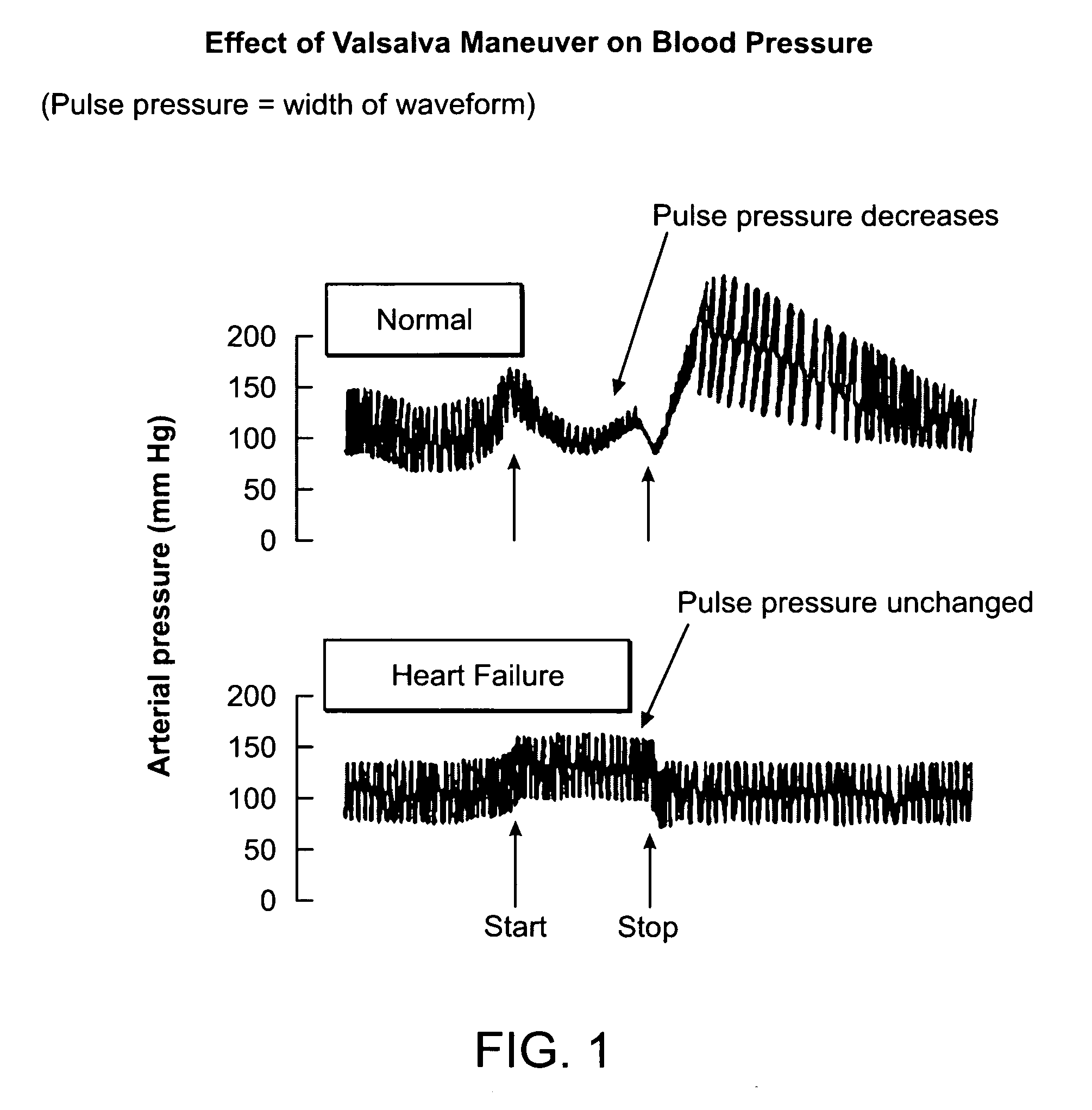 Non-invasive methods and systems for assessing cardiac filing pressure