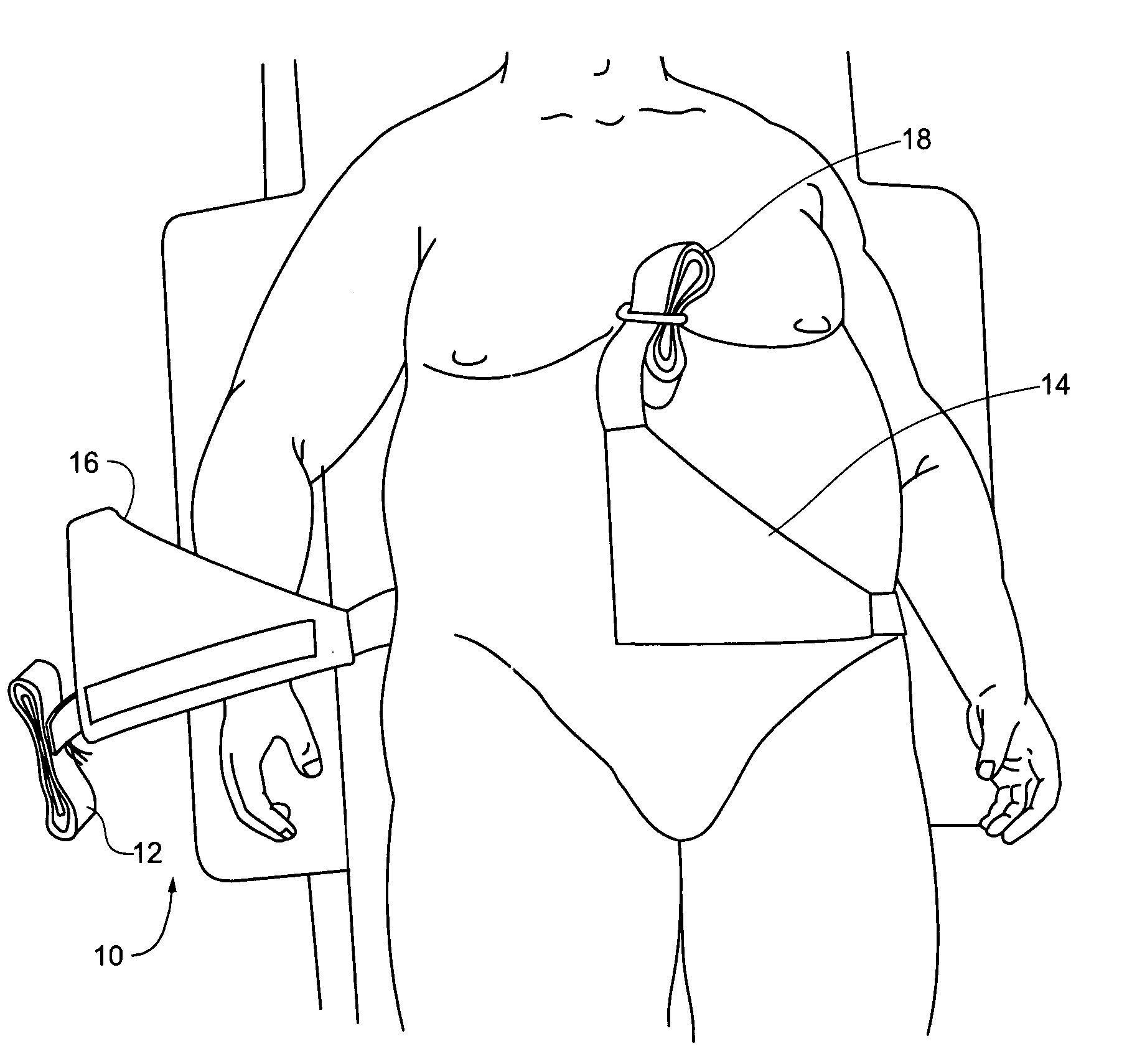 Abdominal tissue support for femoral puncture procedures