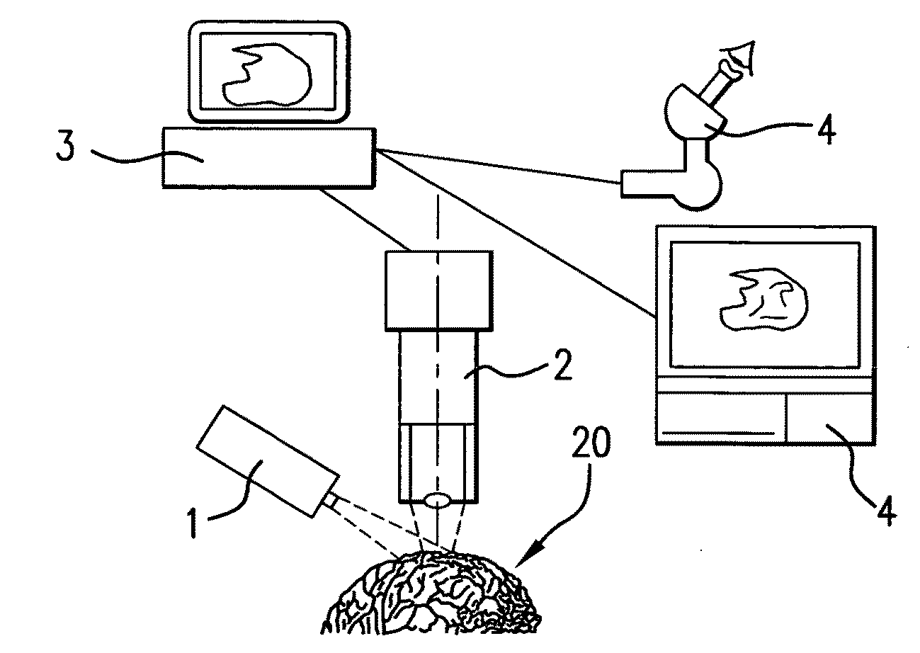 Method for analyzing and processing fluorescent images