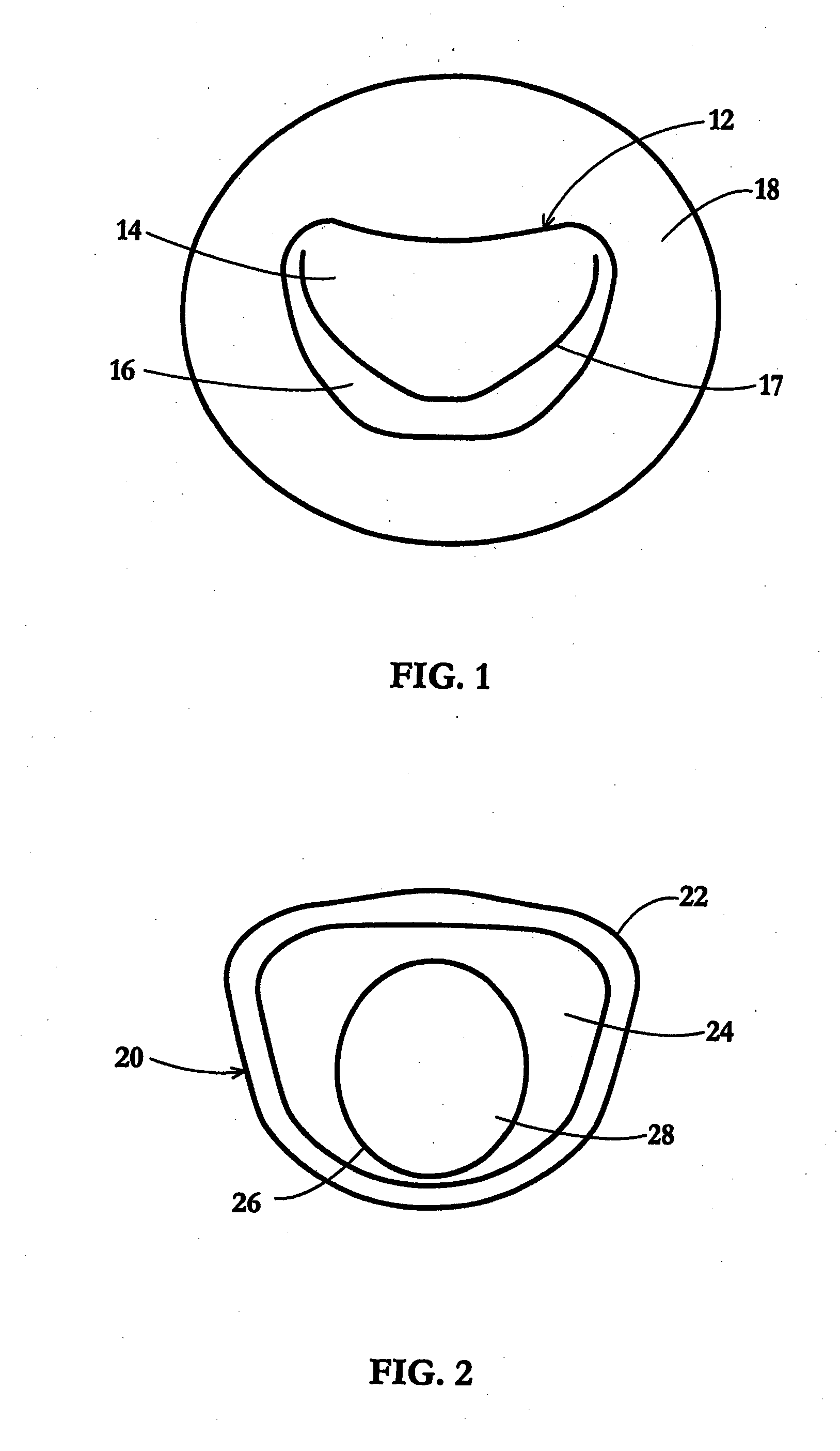 Device and Method for Temporary or Permanent Suspension of an Implantable Scaffolding Containing an Orifice for Placement of a Prosthetic or Bio-Prosthetic Valve