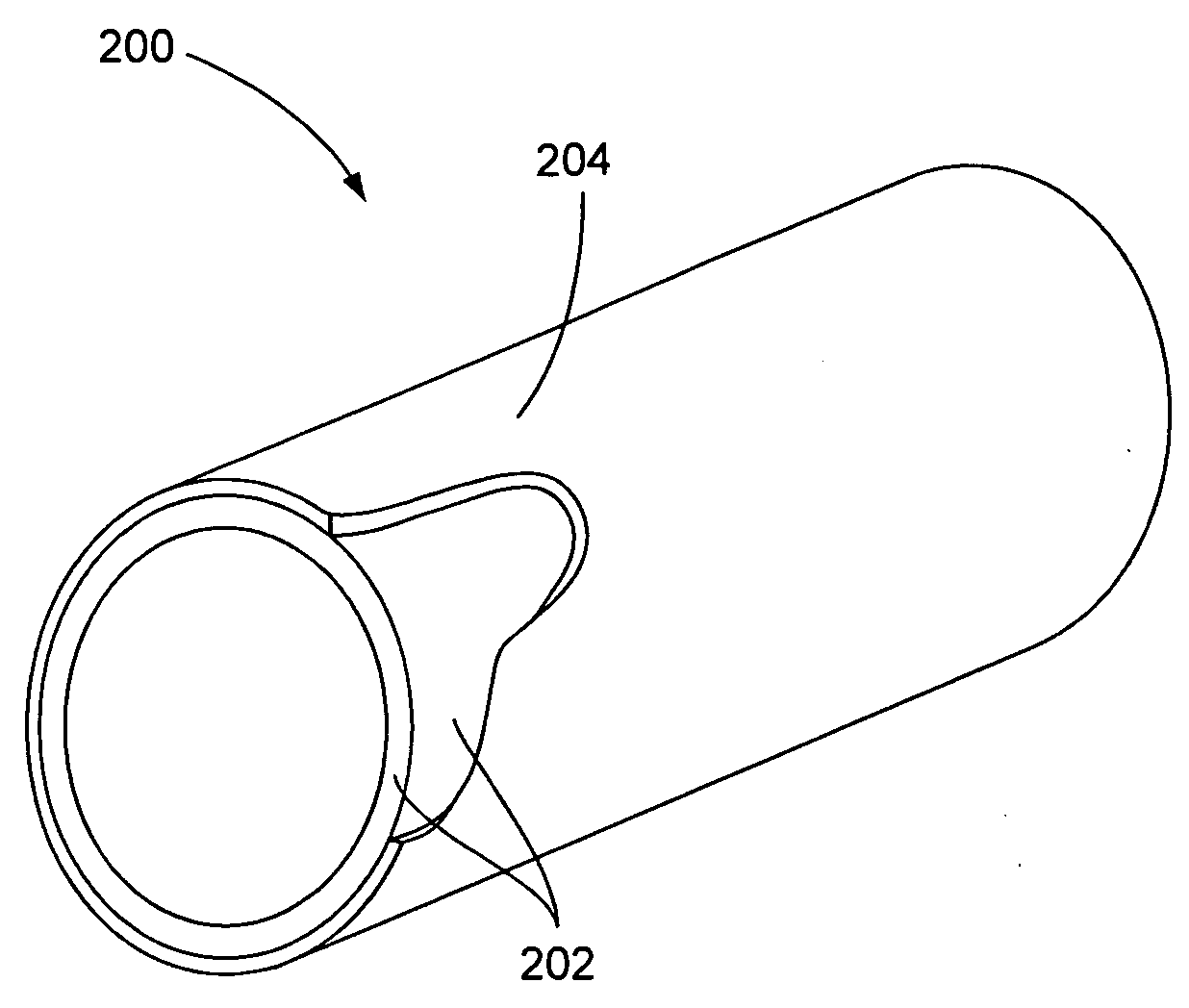 Ten-thousandths scale metal reinforced stent delivery guide sheath or restraint