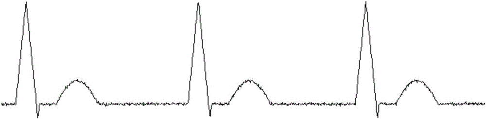 Signal filtering method and system