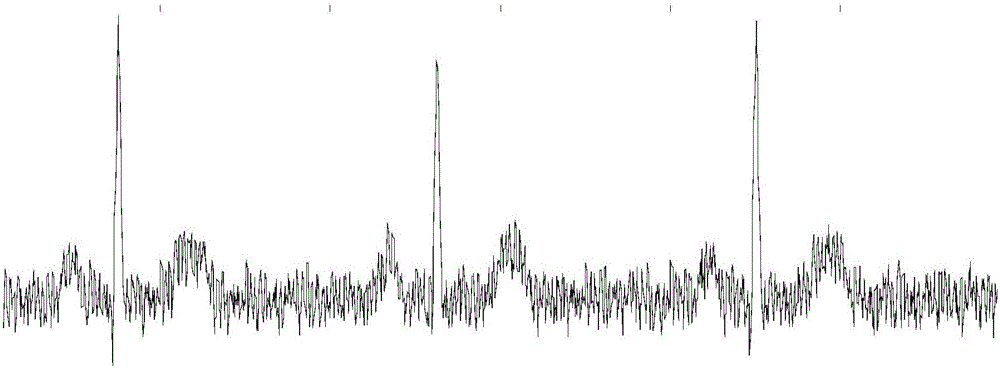 Signal filtering method and system