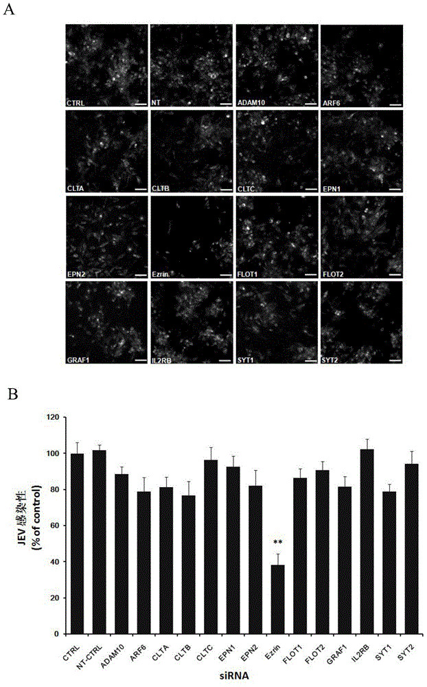 Application of Ezrin in preventing and treating Japanese encephalitis virus infection