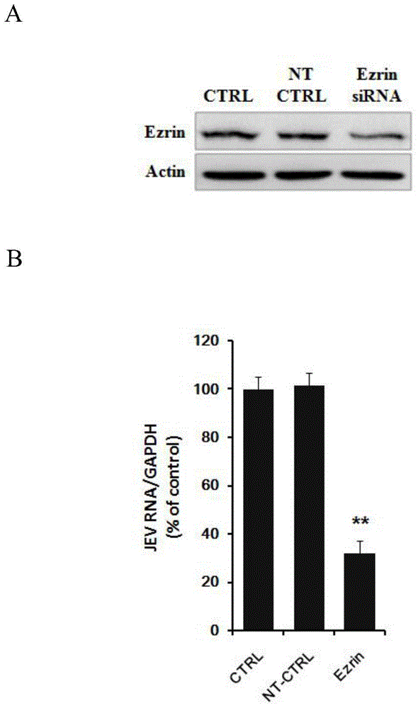 Application of Ezrin in preventing and treating Japanese encephalitis virus infection