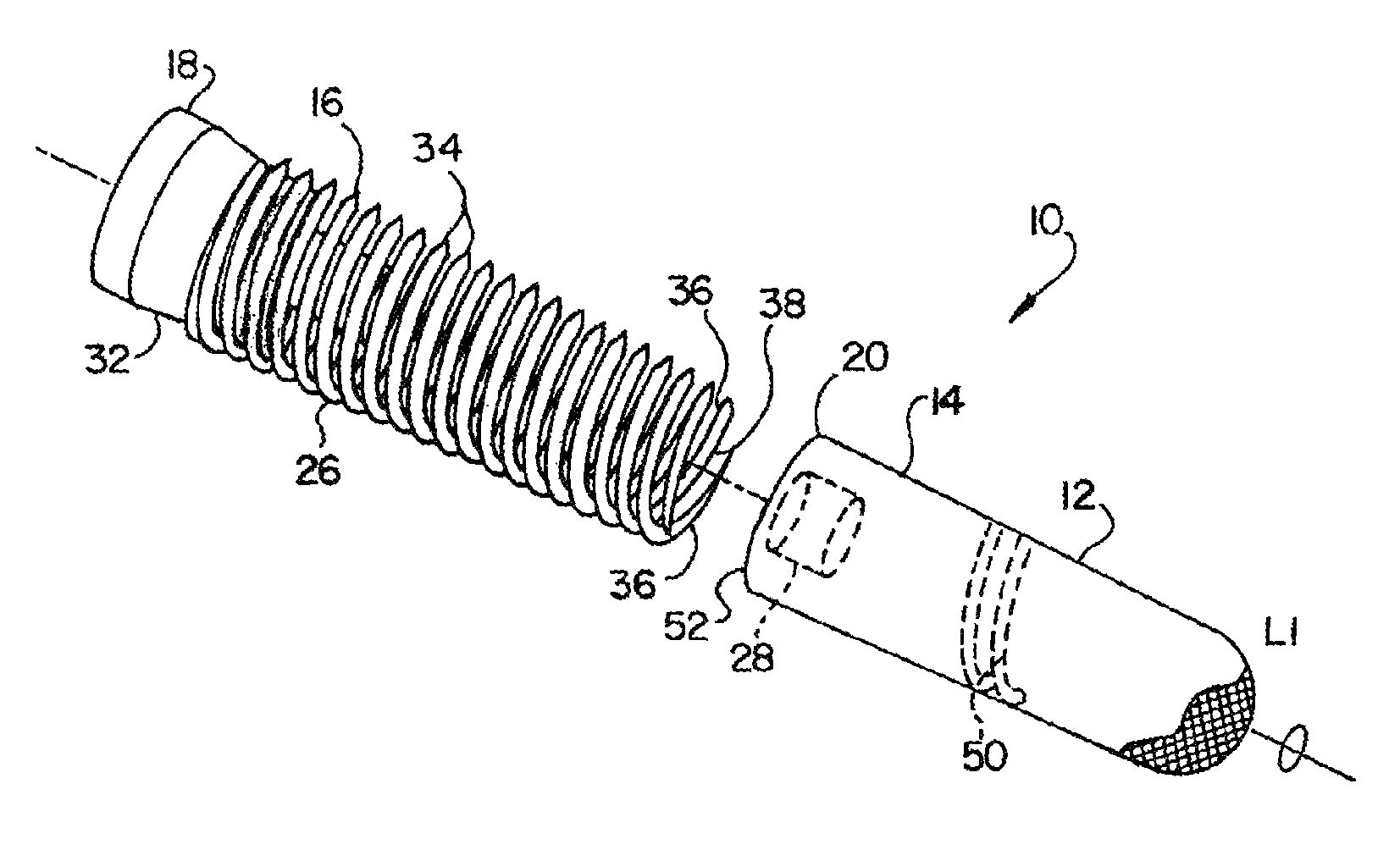 Porous implant with non-porous threads