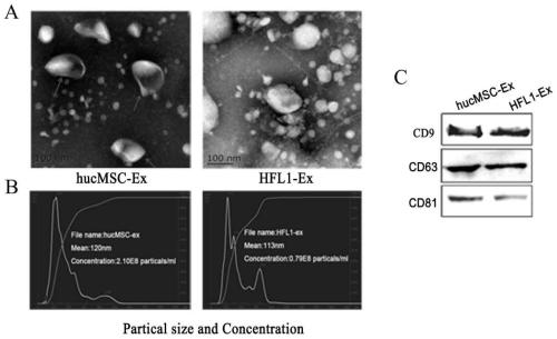 Novel biological preparation for resisting renal fibrosis, of human umbilical cord MSC exosome and preparation method