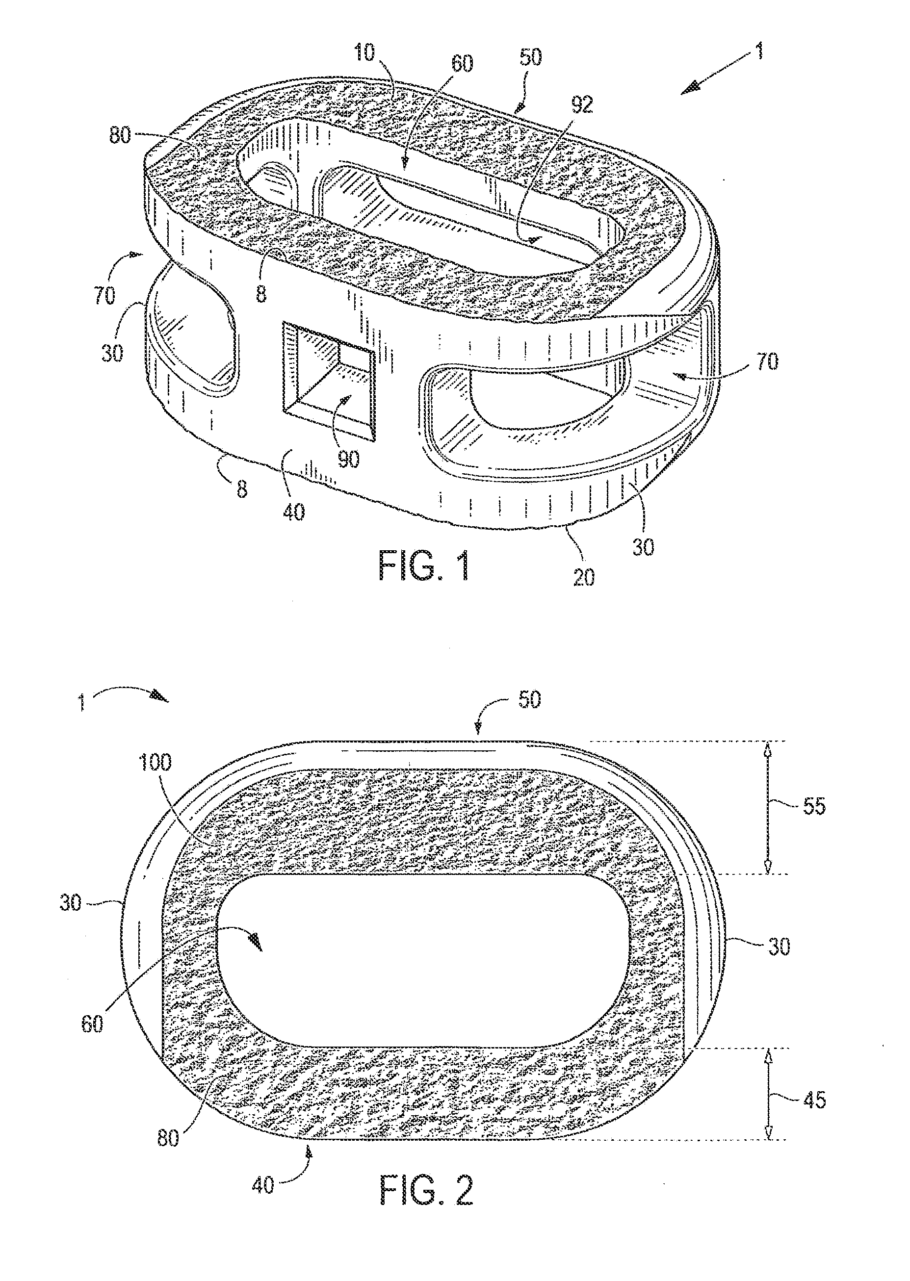 Implant with critical ratio of load bearing surface area to central opening area