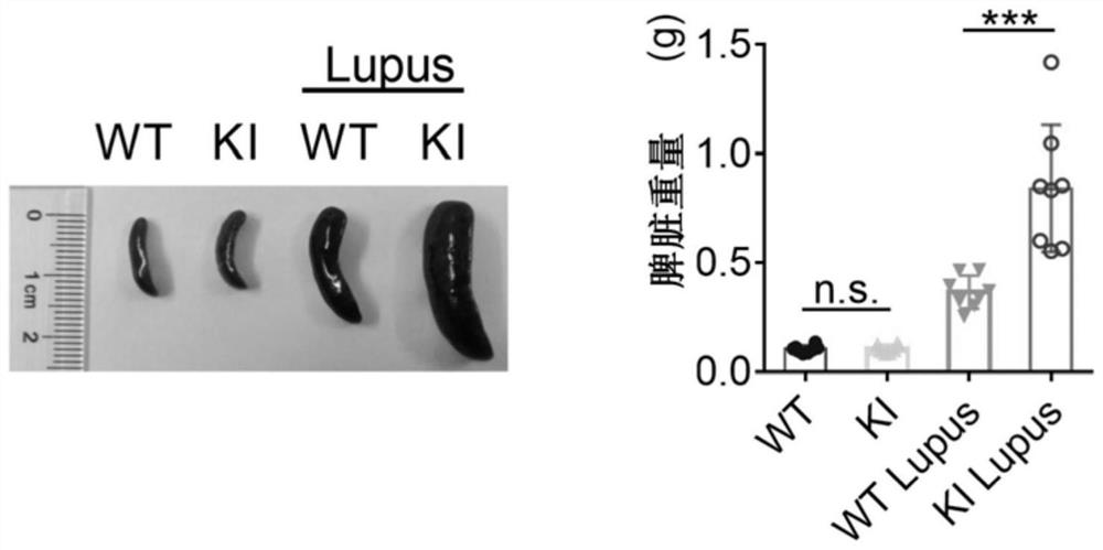 Application of hydroxychloroquine in medicine for preventing and treating systemic lupus erythematosus