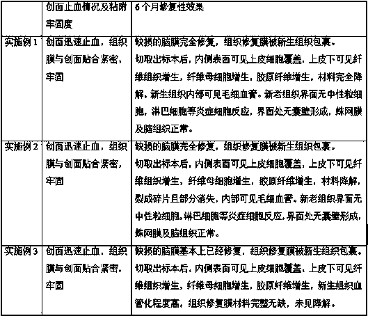 Panax notoginseng loaded hemostatic tissue repair membrane and preparation method thereof