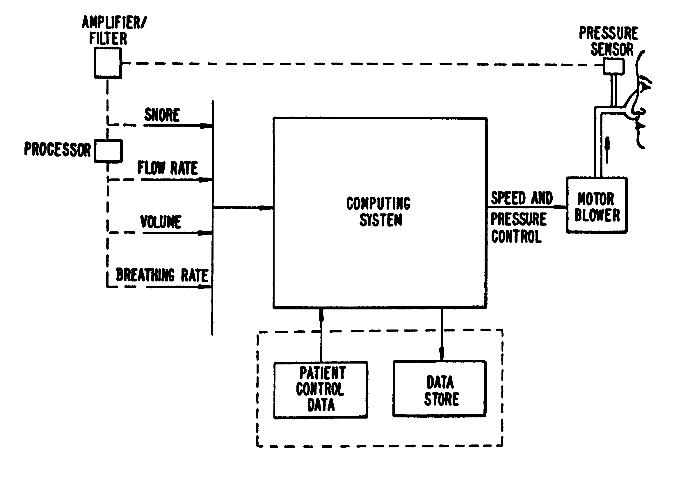 Method and apparatus useful in the diagnosis of obstructive sleep apnea of a patient