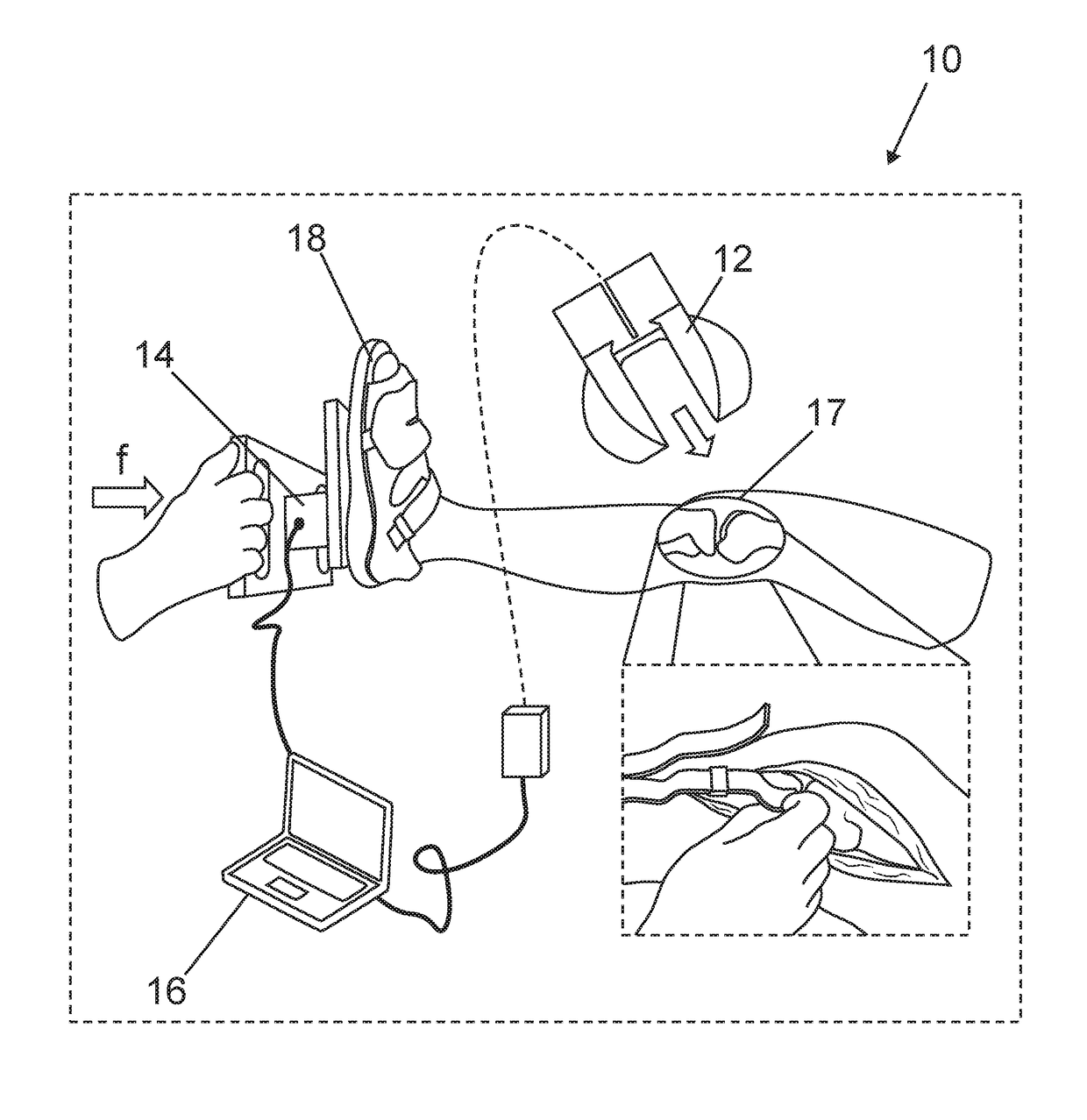 System and method for intraoperative joint contact mechanics measurement