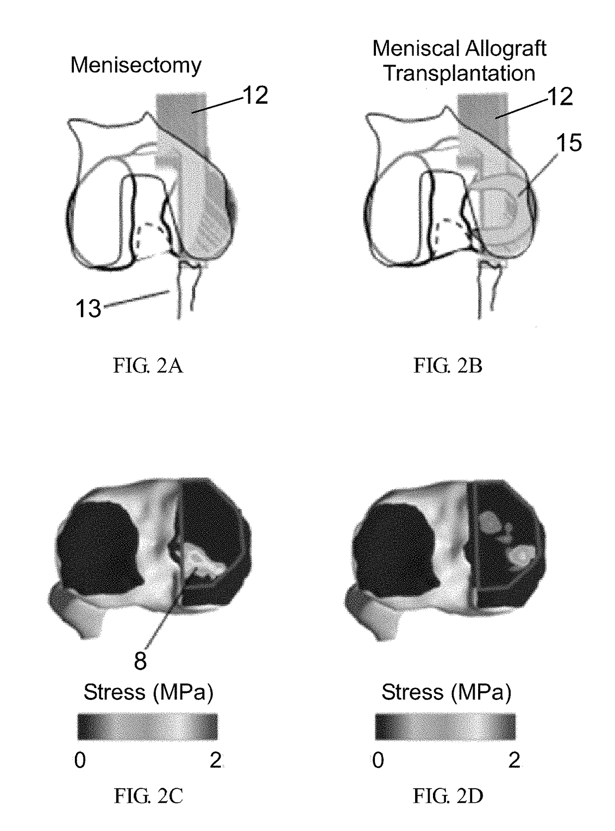 System and method for intraoperative joint contact mechanics measurement