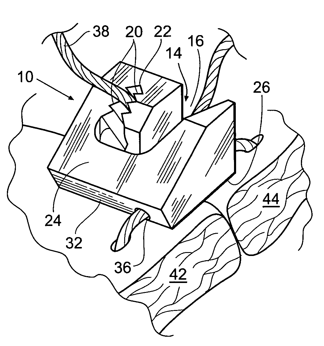 Suture lock